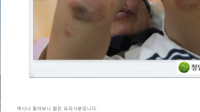 피부질환 한의학 이야기 /화폐상 습진 이야기