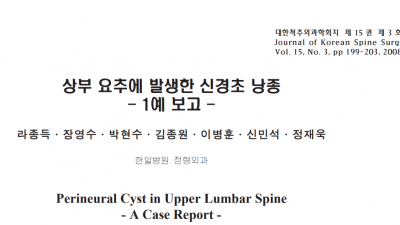 신경초낭종 perineural cyst