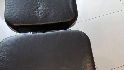 척추관협착증 칼럼