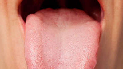 혀만 봐도 건강이? 매일 아침 1분, 혓바닥 건강 자가진단법!