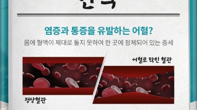 금호역 한약 한의원 – 추나요법과 첩약, 건강보험으로 체계적인 한방치료 받기